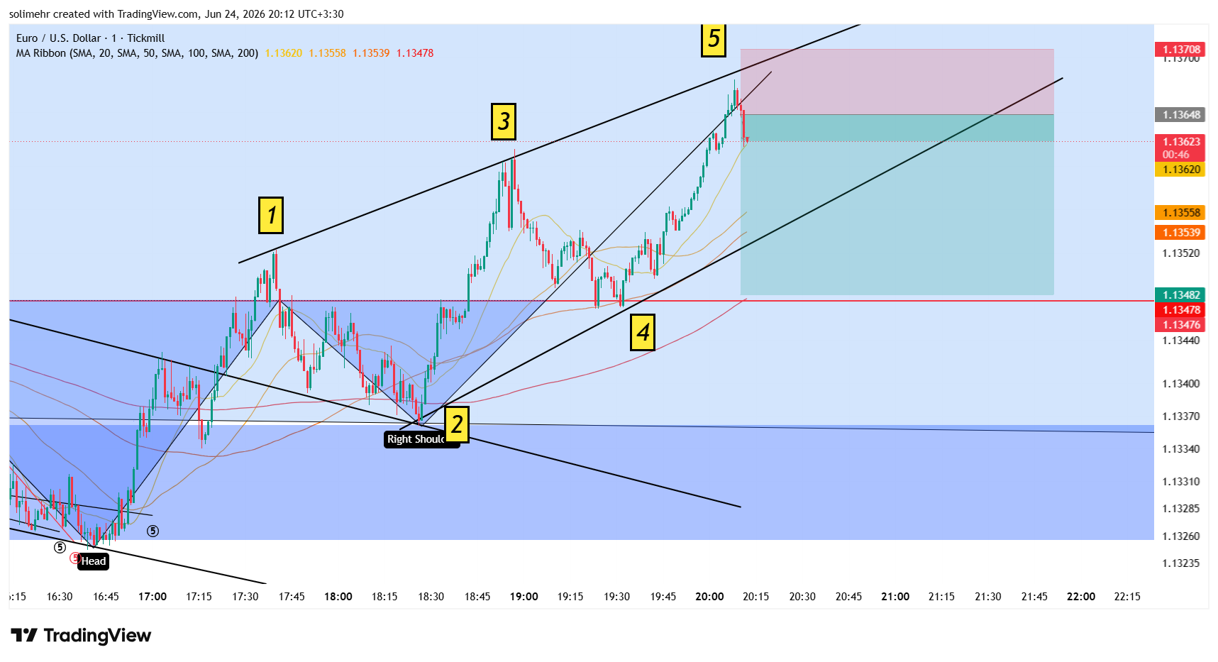 تحلیل EURUSD-141